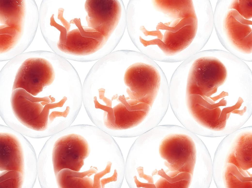 Oto jak sztuczna inteligencja pomaga w rodzeniu dzieci, rewolucjonizując in vitro